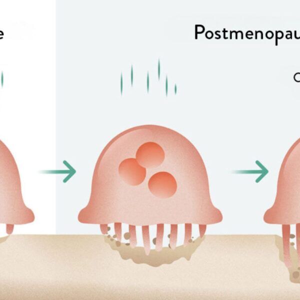 Cortisol and Menopause-2